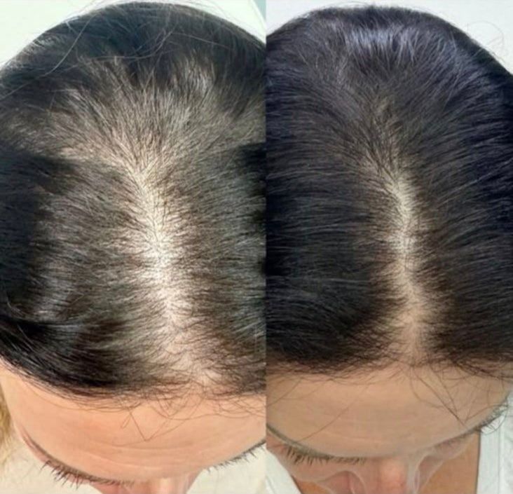 Tib-E-Zulf Hair Oil